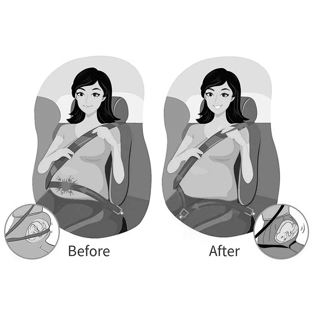 Babysecure™ - Pregnancy Seat Belt Adjuster